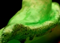 Unfertilized Egg (Belly Button) Detail 3