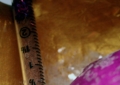 Ambigious Fetus (Needle/Hair Detail)