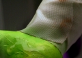 Conditions vs Procedures 1 (Heel Stick Detail)