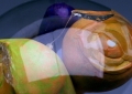 Conditions vs Procedures 2 (Eye Detail)